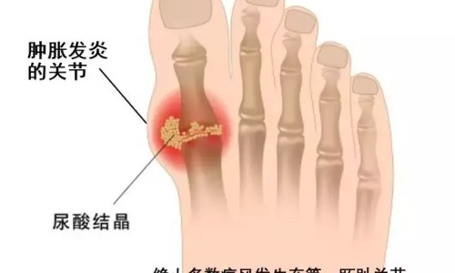 脸上长红豆豆一摸就疼-脸上起豆发红发痒怎么办最有效,中国脸上长豆外圈红中发硬是怎么回事网站